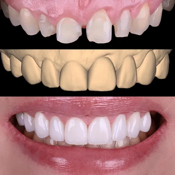 Patient image 2