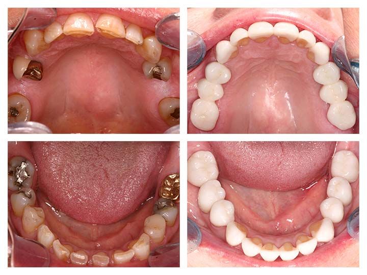 Patient image 1