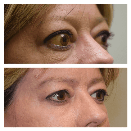 Patient image 3
