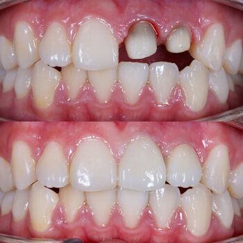Patient image 1