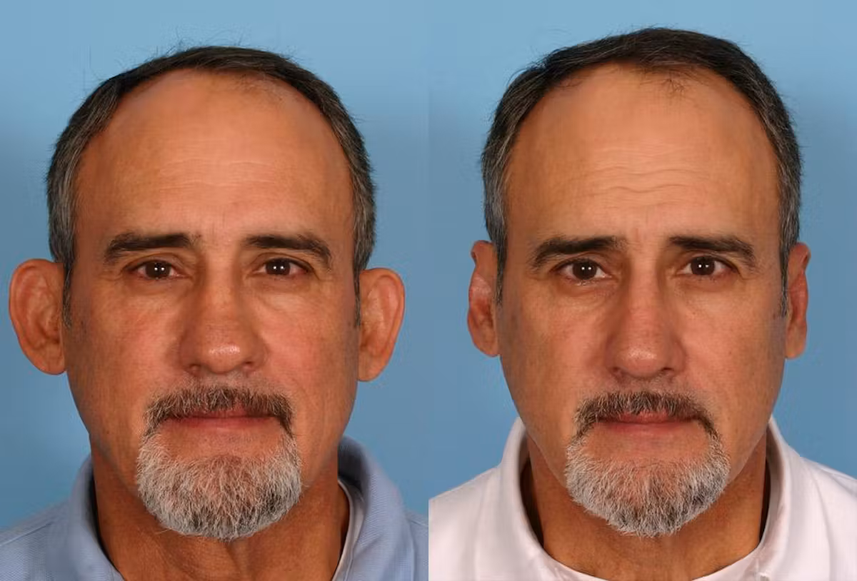 Patient image 1