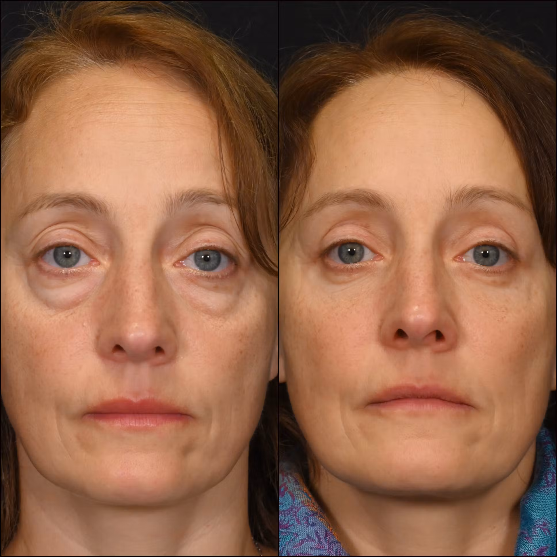 Patient image 2
