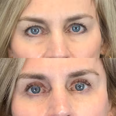 Patient image 1