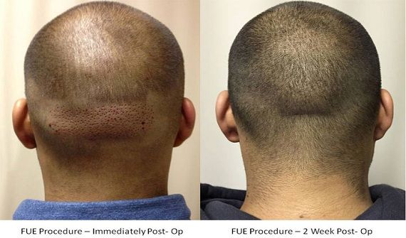 Patient image 2