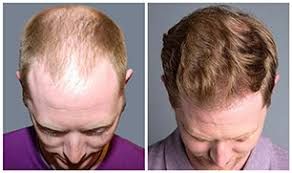 Patient image 1