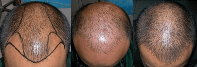 Patient image 4
