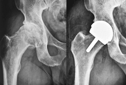 Patient image 2