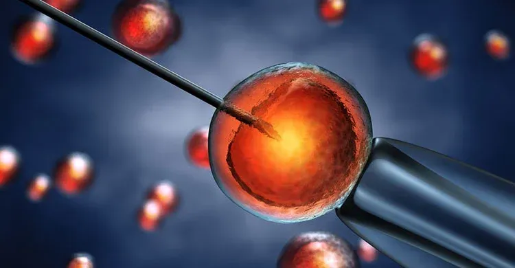 ICSI (Intracytoplasmic Sperm Injection)