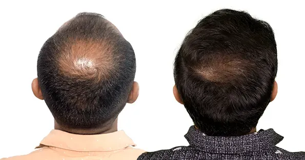 Patient image 1