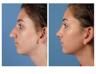 Patient image 4