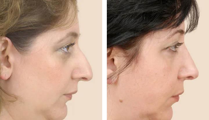 Patient image 3