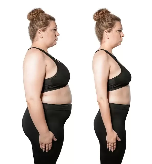 Patient image 1