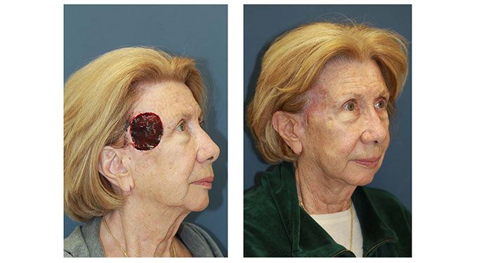 Patient image 1