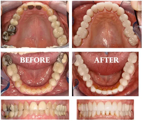 Patient image 2