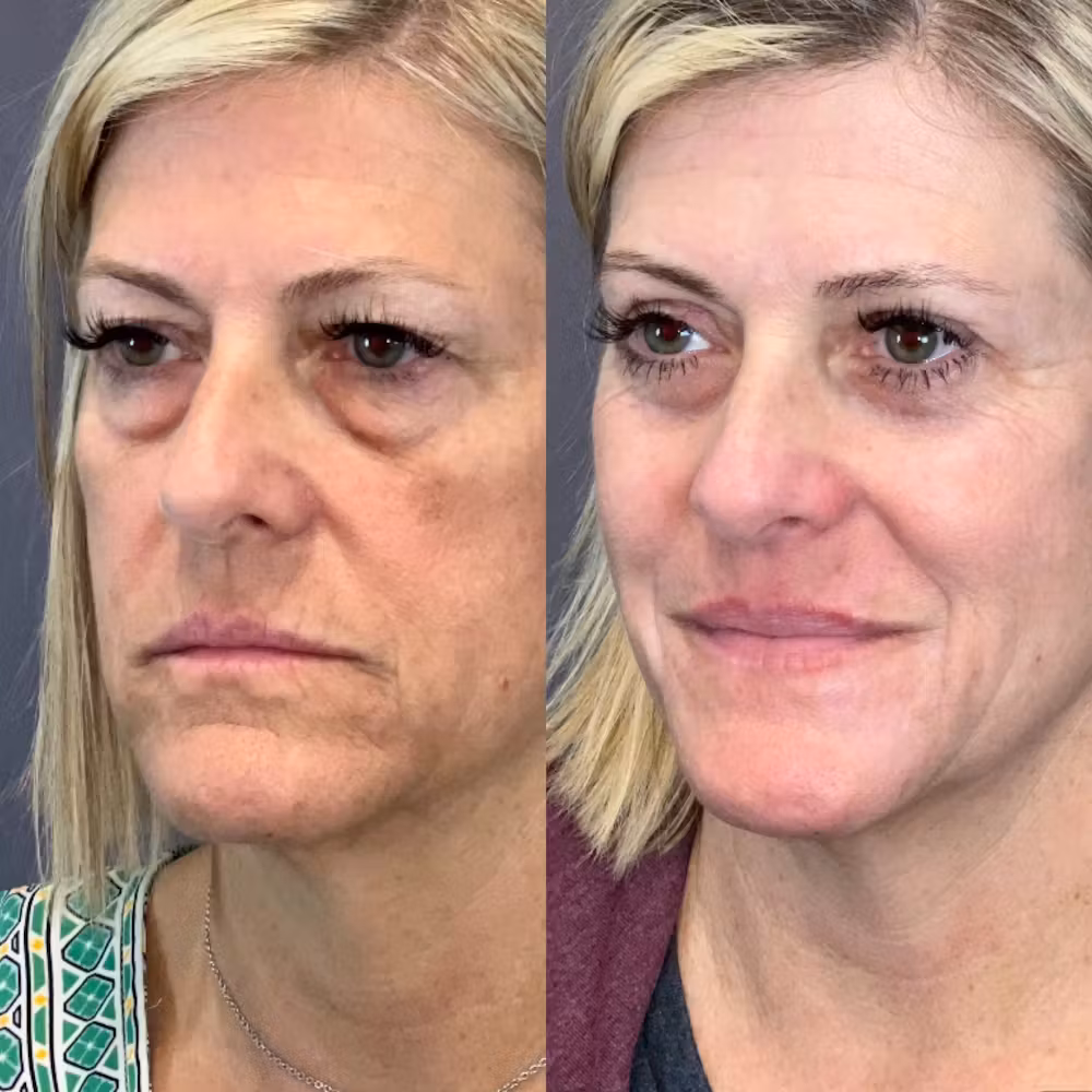 Patient image 2