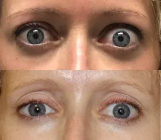 Patient image 1