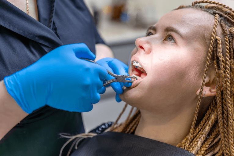 Orthodontics Treatment