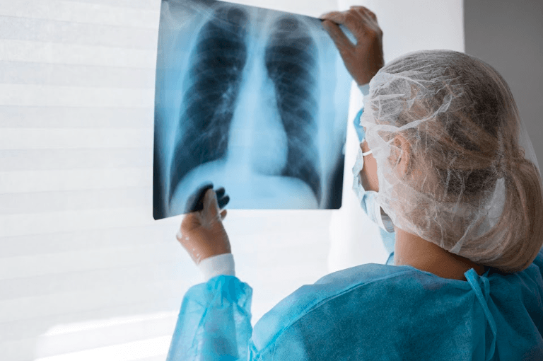 TILs Therapy for NSCLC (Non‑Small Cell Lung Cancer)