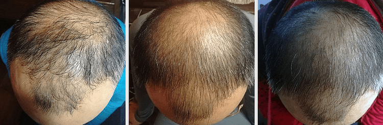 Patient image 4
