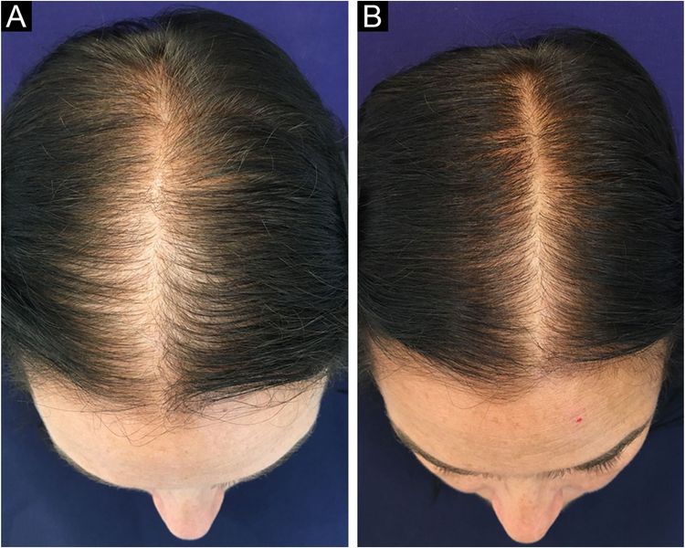 Patient image 3