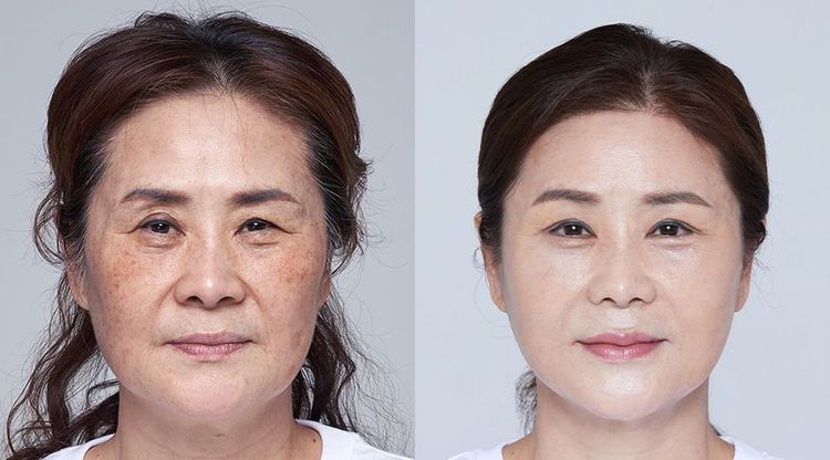 Patient image 2