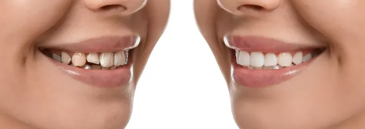 Patient image 4