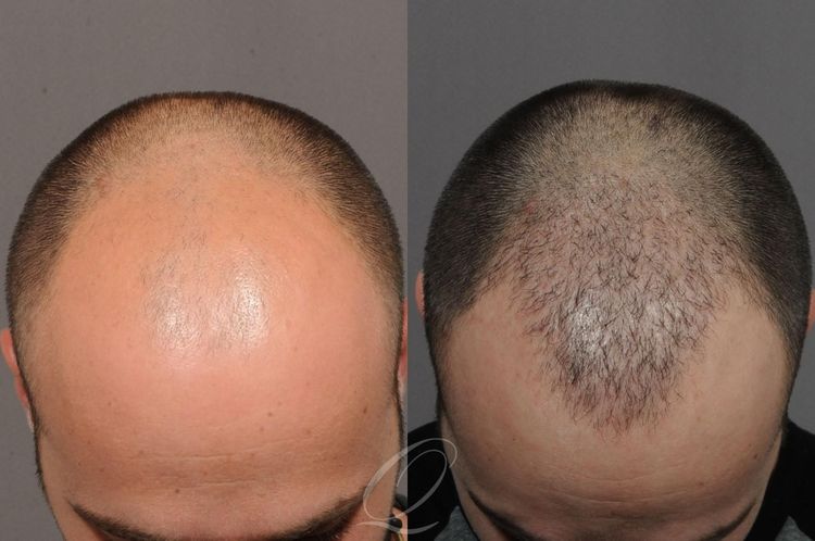Patient image 3