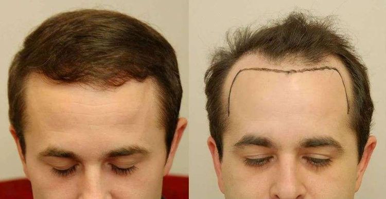 Patient image 2