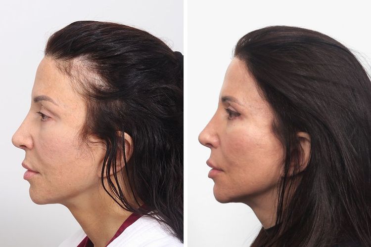 Patient image 2