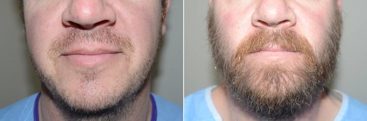 Patient image 2