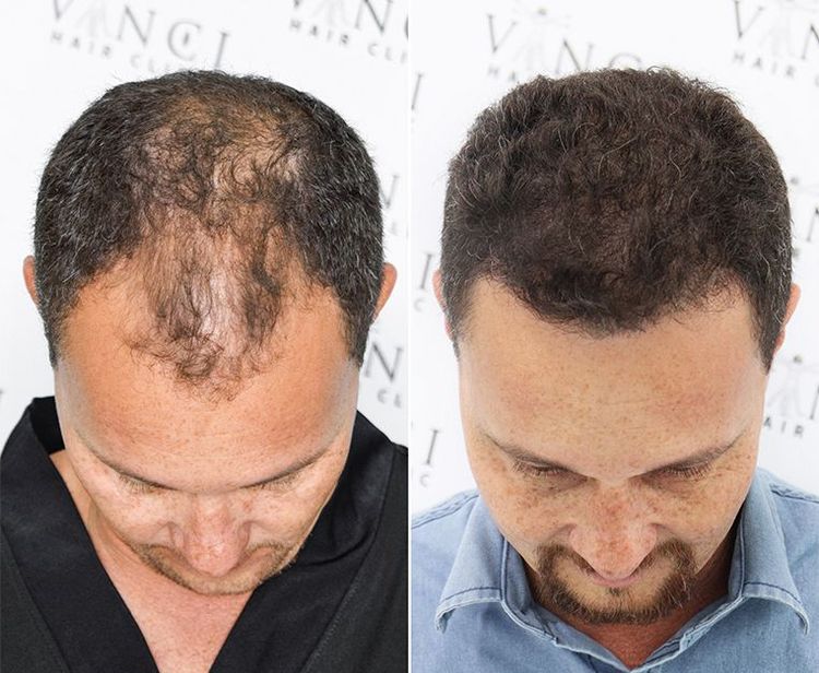 Patient image 3
