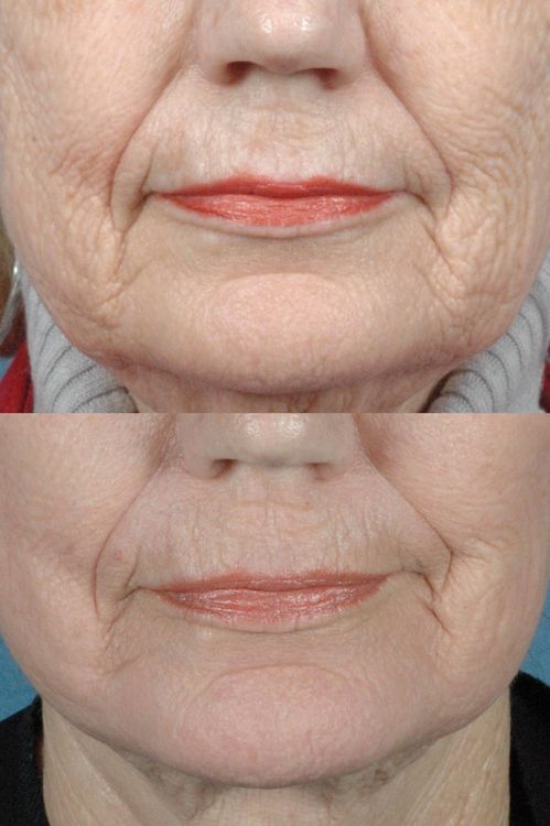 Patient image 4