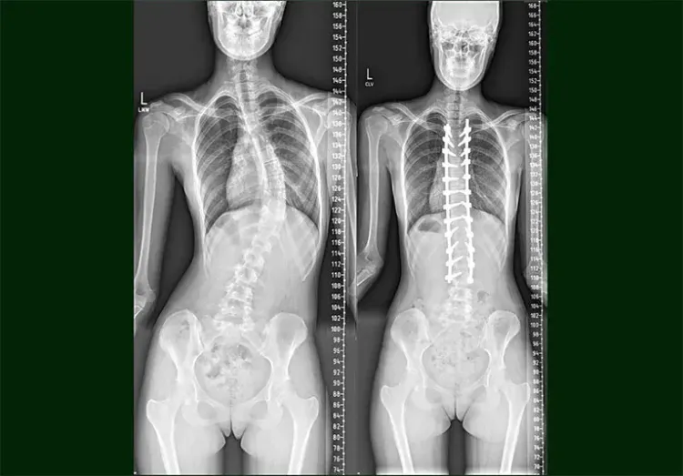 Patient image 2