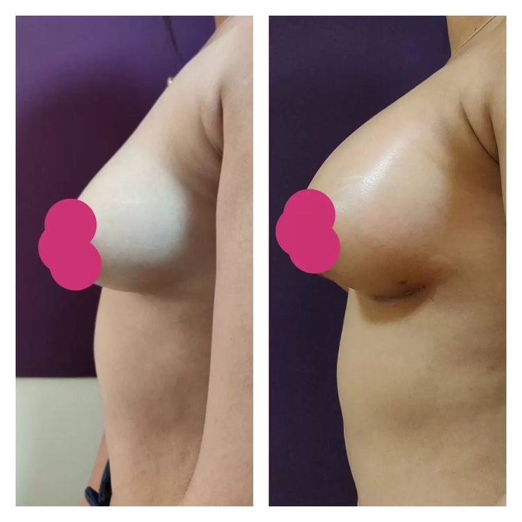Patient image 2
