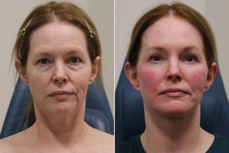 Patient image 1