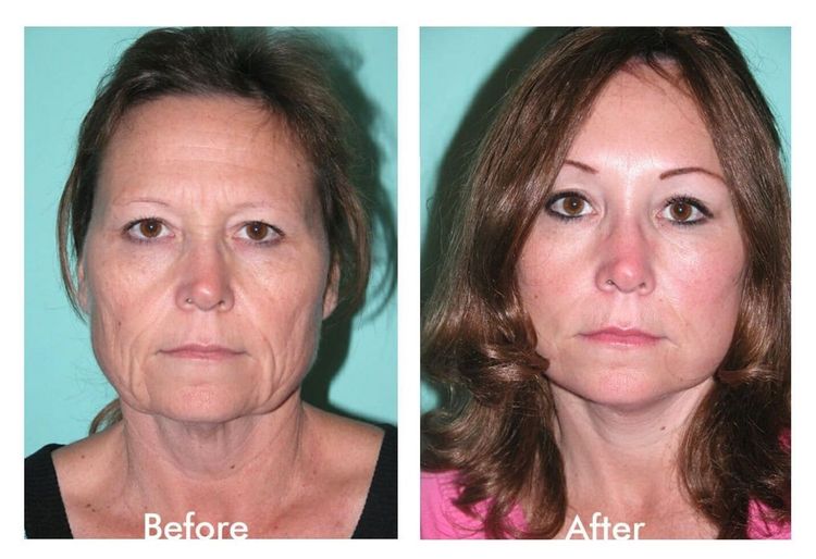 Patient image 5