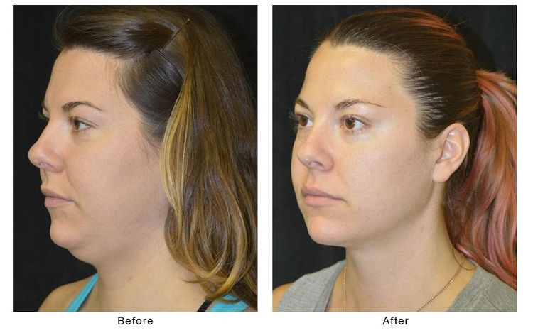 Patient image 3