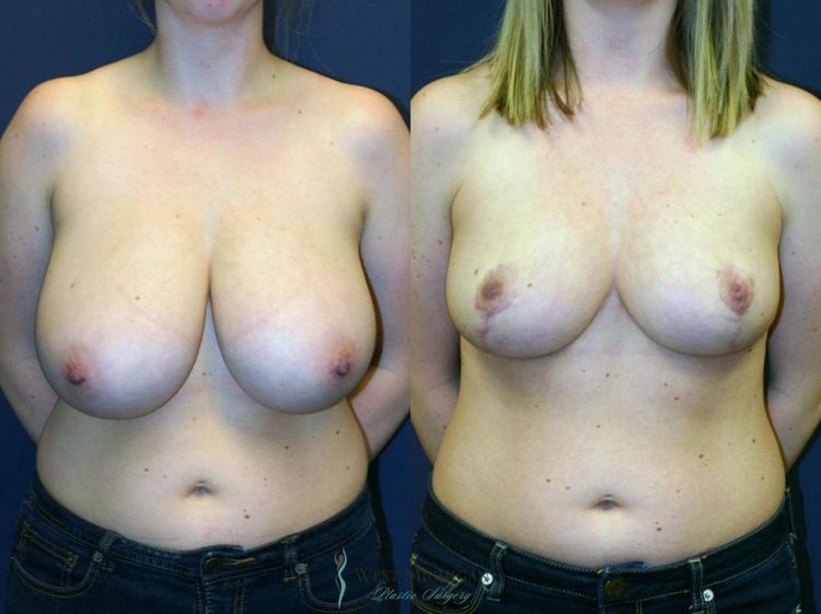 Patient image 4