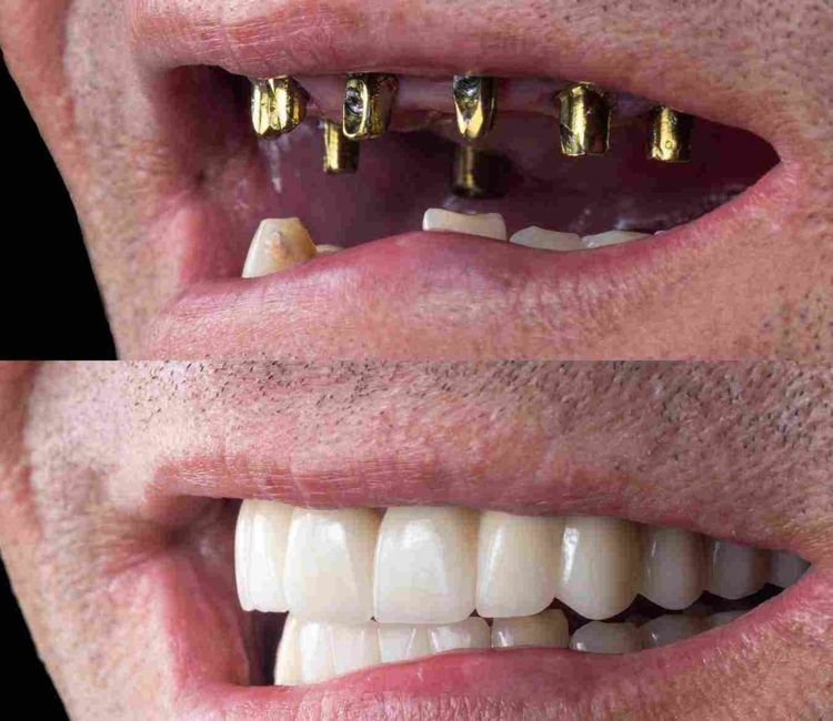 Patient image 5