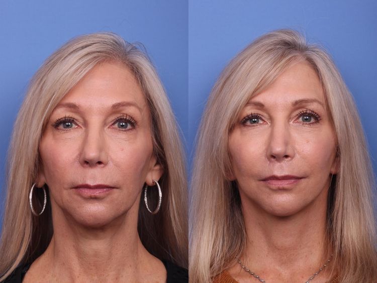 Patient image 4