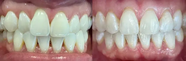 Patient image 3