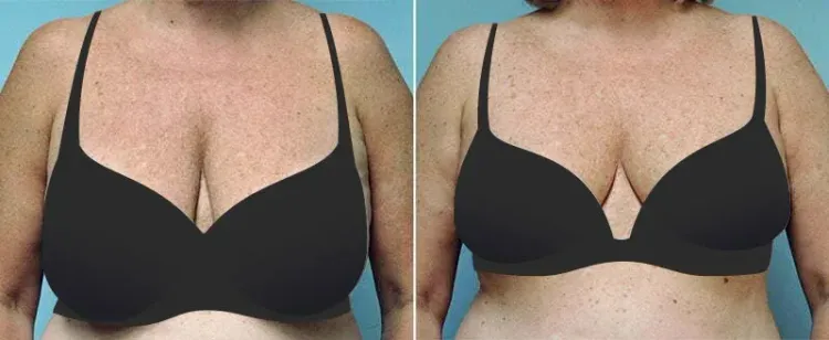 Patient image 4