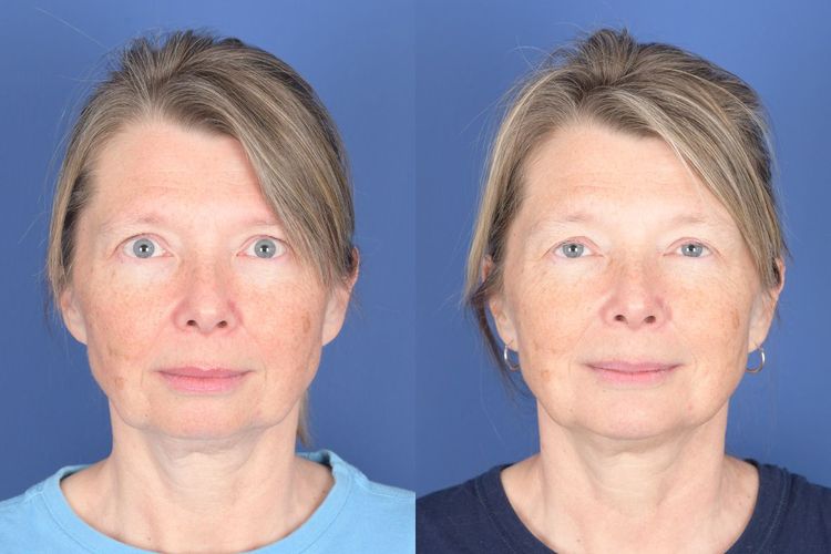 Patient image 3