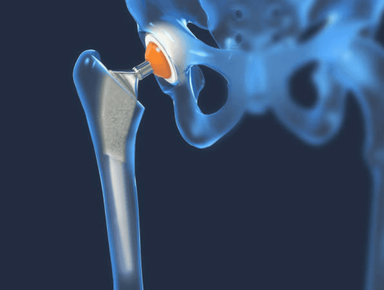 Patient image 3