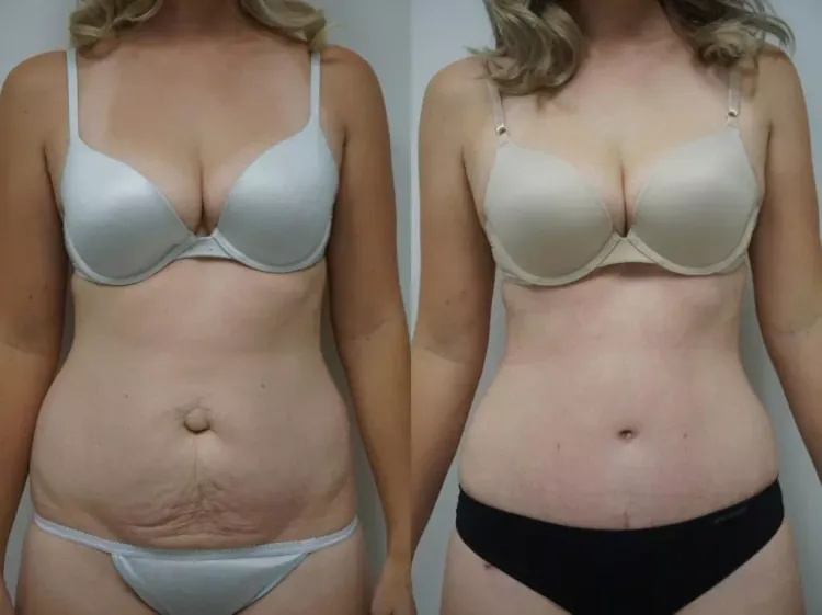 Patient image 3