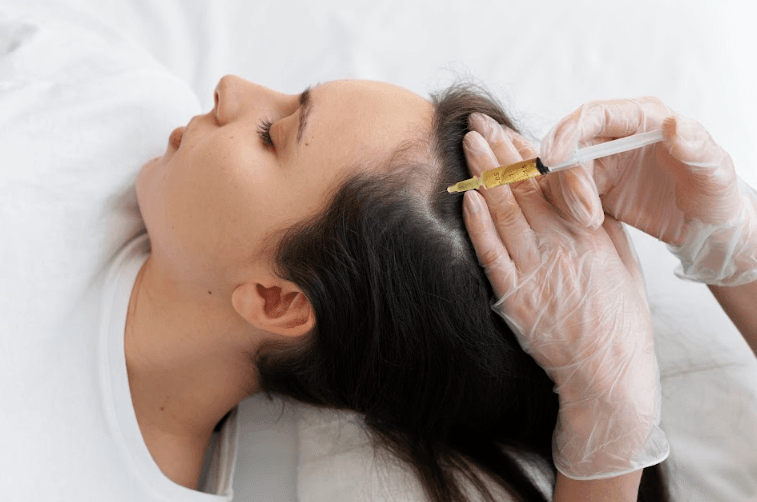 Mesotherapy for Hair Treatment