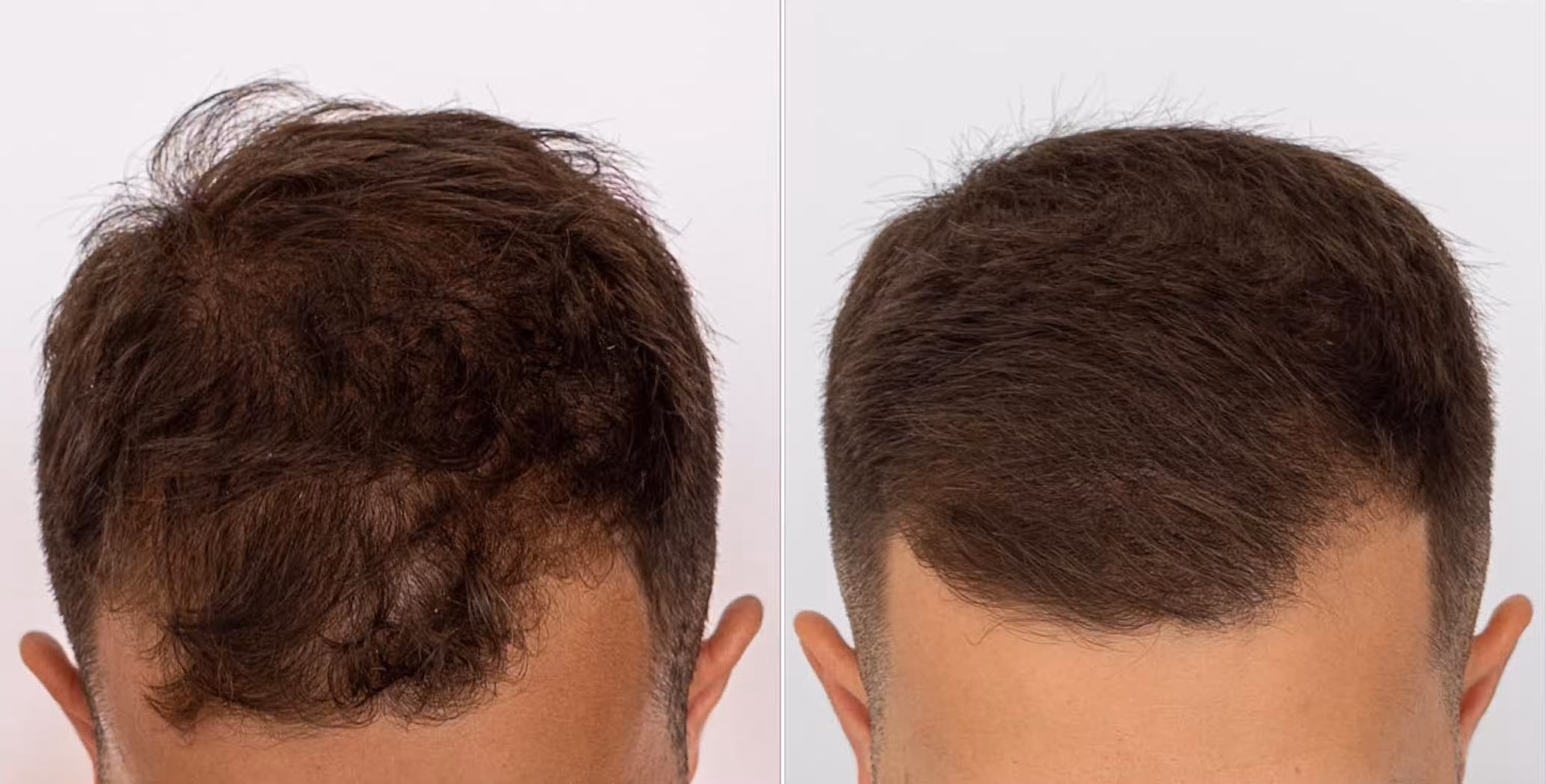 Patient image 2