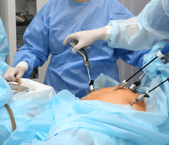 Obesity/Bariatric Surgery