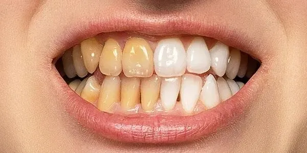Patient image 2