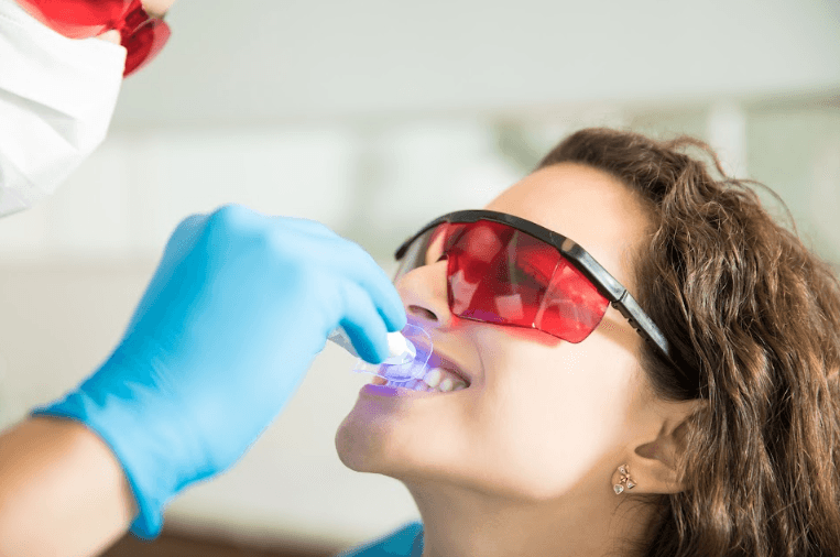 Teeth Whitening